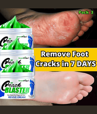 Smartdrops Cracked Heel Repair Cream Feet Cream Foot Cream SPF 15 ( 50 g )