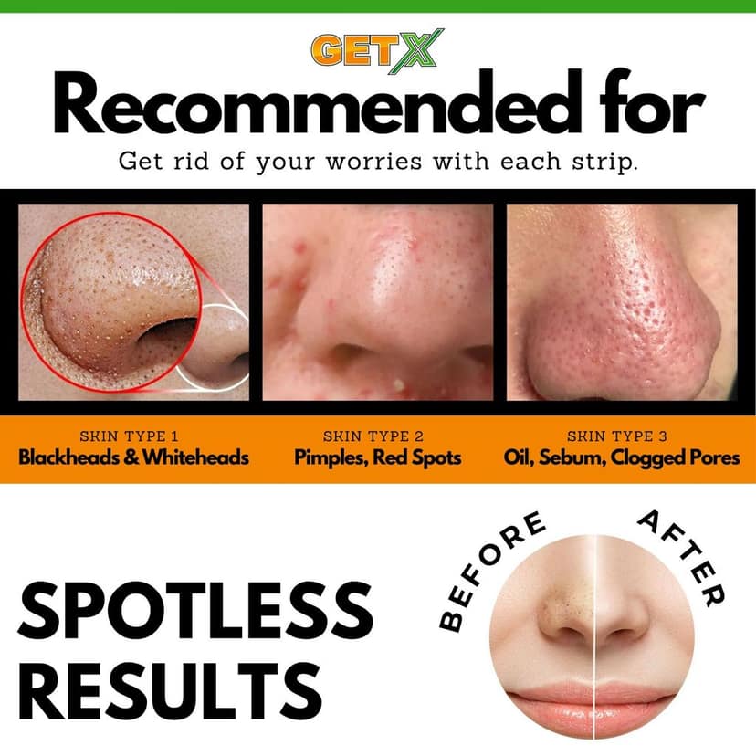 GETX Charcoal Nose Strips (10 Strips), Deep Cleansing Charcoal Nose Pore Strip for Men & Women | Reduces & Prevents Blackheads, Whiteheads, Dirt and Oil | Cleanses Pores view 5