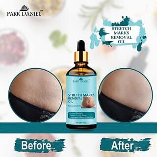 PARK DANIEL Premium Stretch Marks Removal Oil & Even Out Skin Tone Pack of 1 30 ML (30 ml)