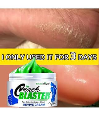 Smartdrops Fast Rellef For Fingers & Feet Crack Cream Foot Cream SPF 15 ( 100 g ) Pack of 2