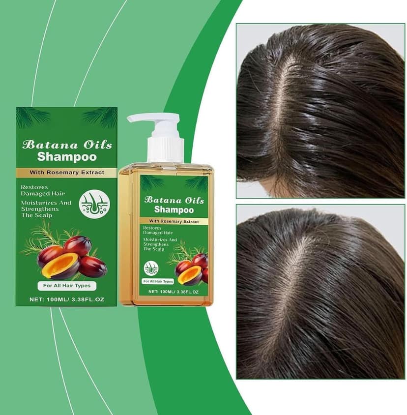 ELHAE Batana Oils Shampoo With Rosemary Extract | For All Hair Types | Nourishing Cleanser That Helps Moisturize & Strengthen Scalp and Hair | Gentle Use Daily Shampoo (200ml) view 2