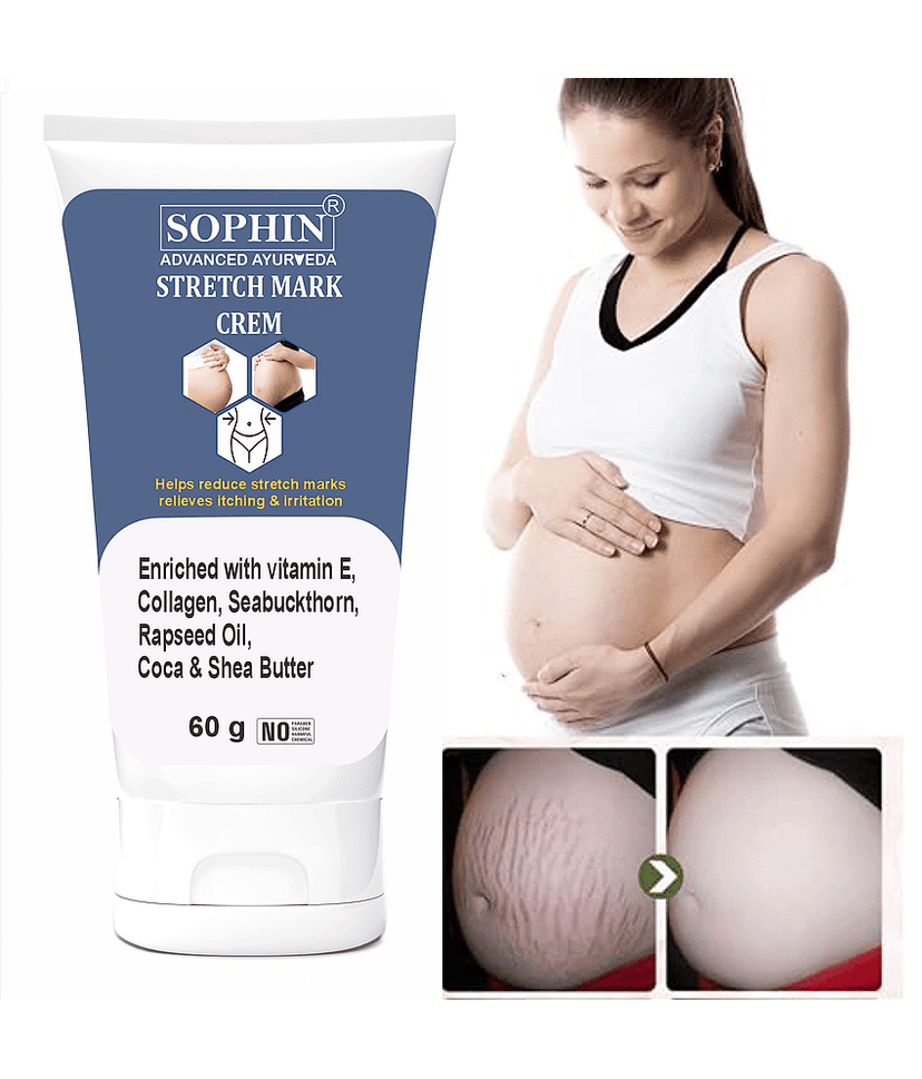 SOPHIN Black & White Head Removal Cream ( 60 g )