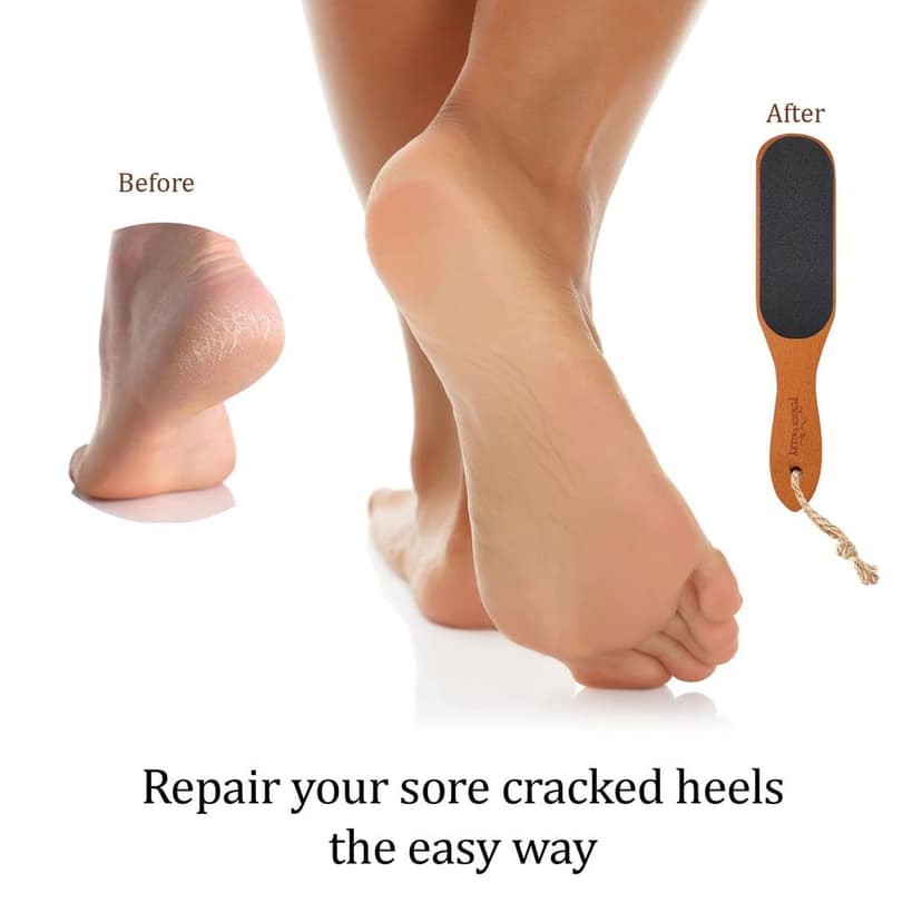Elecsera Foot File For Dead Skin Removal Pack of 1 view 3