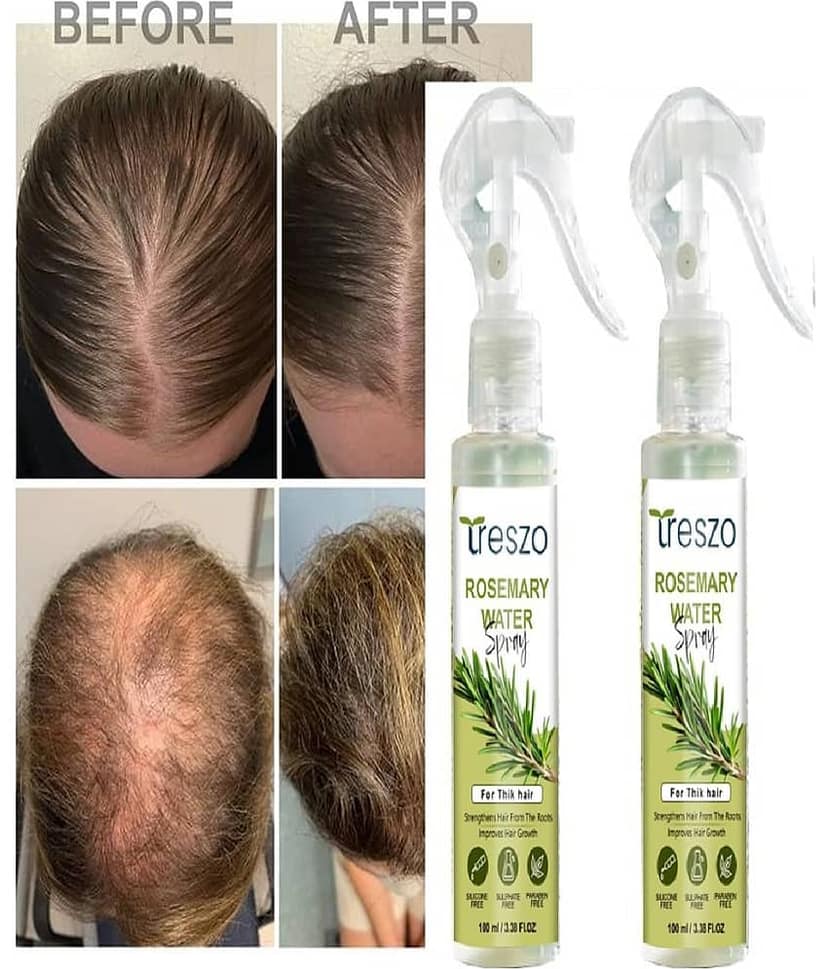 Treszo Rosemary Hair Growth Hair Serum 100 mL Pack of 2