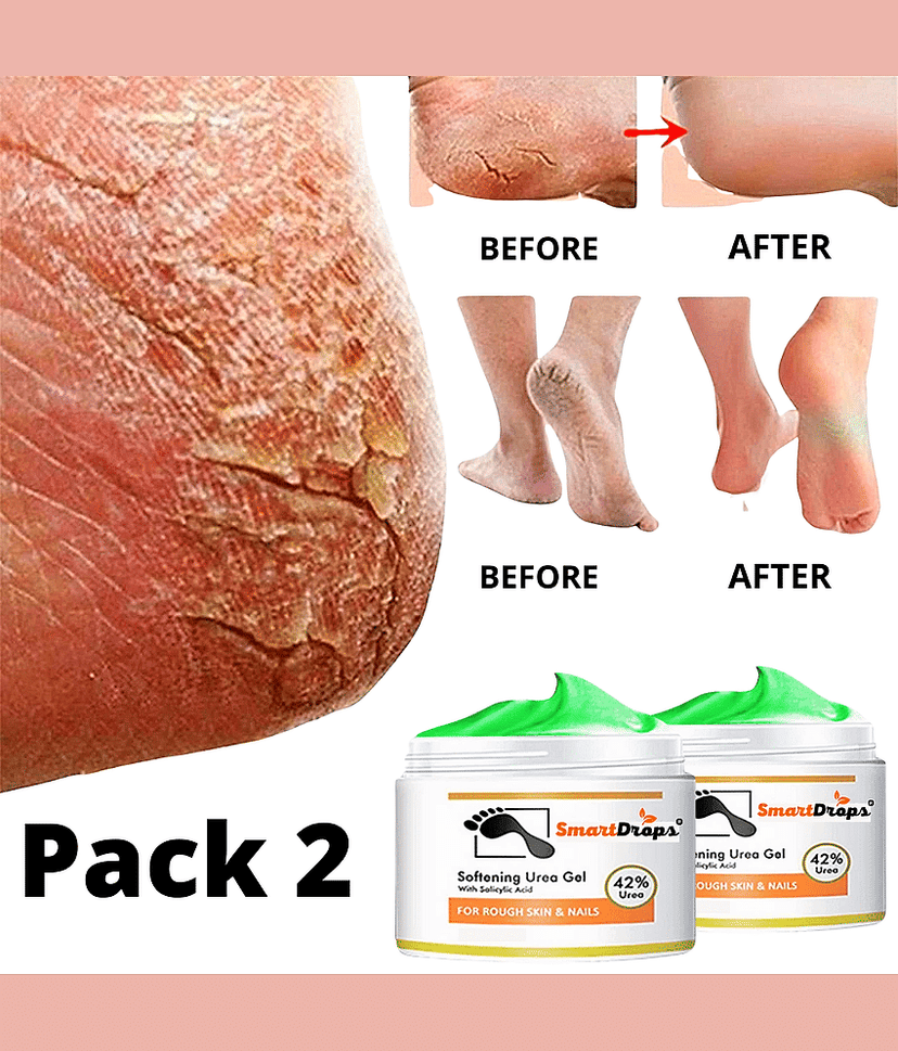 Smartdrops Smartdrops Foot Cream SPF 24 ( 50 g )