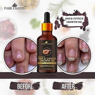 PARK DANIEL Premium Nail & Cuticle Growth Oil- For Nail Growth, Repair & Cuticle Care(30 ml) Yellow ()