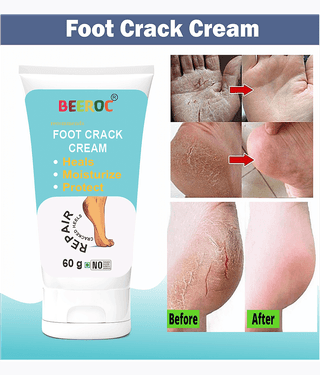BEEROC Cracked skin repair Cream for All year ( 60 g )