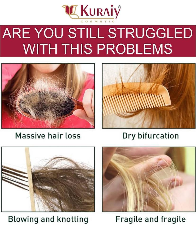 KURAIY RED ONION CONDITIONER FOR HAIR GROWTH & REDUCE HAIR FALL 200ML view 2