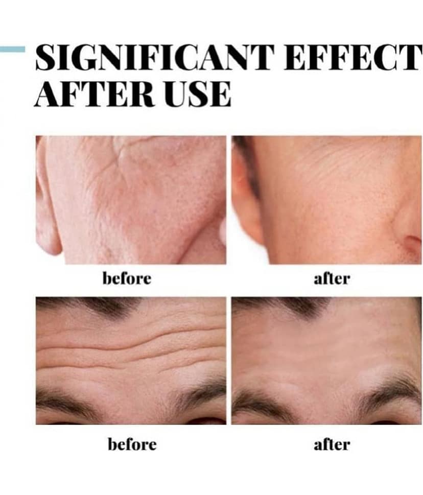 KURAIY Anti Aging Facial Cream Anti Aging Facial Cream Pack Of1 50gm view 2
