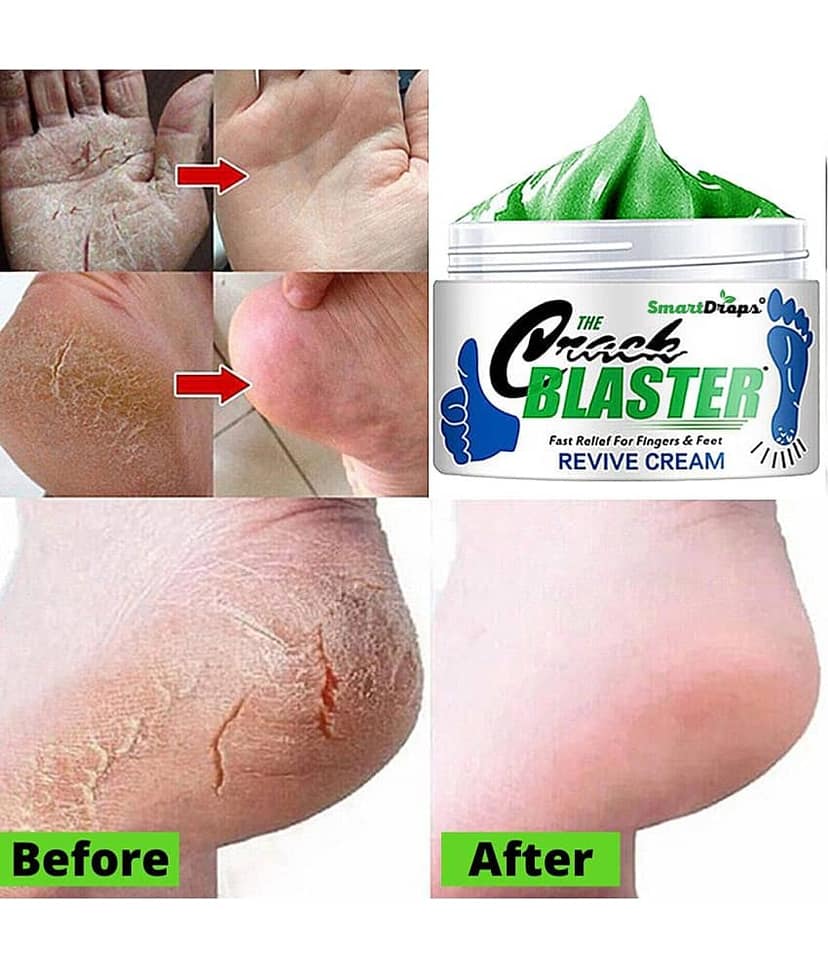 Smartdrops Smartdrops Foot Cream SPF 24 ( 150 g )