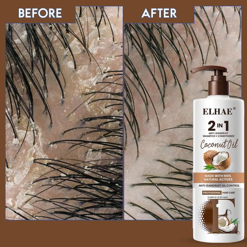 ELHAE 2-in-1 Anti Hairfall and Anti Dandruff Shampoo with Conditioner for Women and Men | Hairfall Control, Dandruff Protection, and Coconut Oil Extract for Oil Control - 300ml view 7