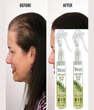 Treszo Rosemary Hair Growth Hair Serum 100 mL Pack of 2