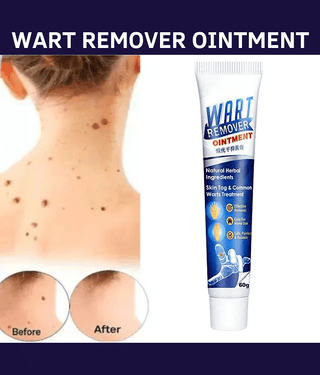Massa Wart Remover Cream For Skin For Wart Free Skin For Men Or Women