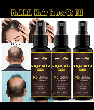 Smartdrops Anti Dandruff Coconut Oil 300 ml ( Pack of 3 )