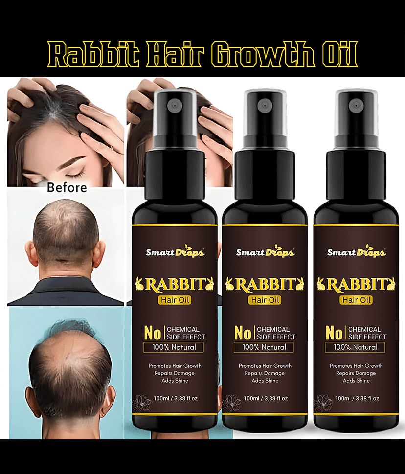 Smartdrops Anti Dandruff Coconut Oil 300 ml ( Pack of 3 )