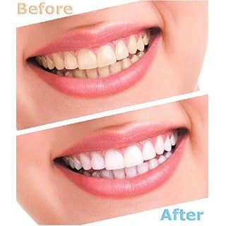Luma Smile Tooth Polisher Whitener Stain Remover with LED Light view 2