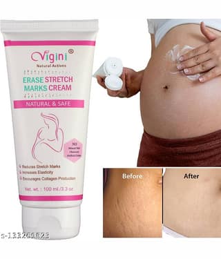 Vigini Stretch Marks Scars Removal Cream