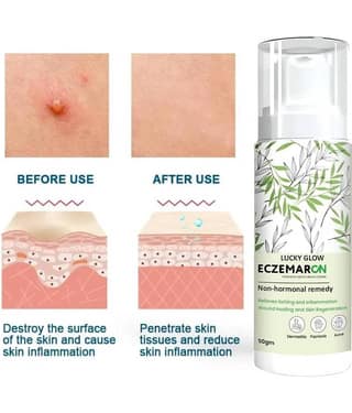 Treszo - Night Cream for All Skin Type 50 ml ( Pack of 1 )