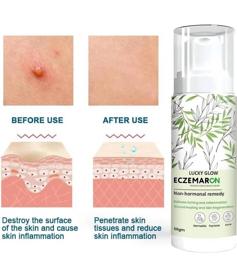 Treszo - Night Cream for All Skin Type 50 ml ( Pack of 1 )