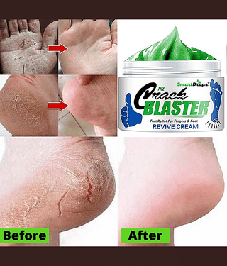 Smartdrops Repair Specialist Cream Foot Cream Foot Cream SPF 15 ( 50 g )