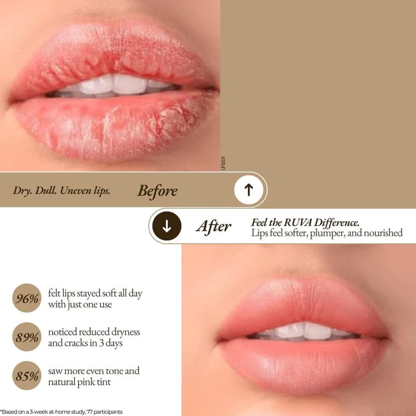 RUVA Soothing Ayurvedic Lip Balm with Natural Pure Damask Rose & Organic Ghee | Nourishing, Herbal Lip Care, Natural Skincare | For All Skin Types - Men & Women view 4