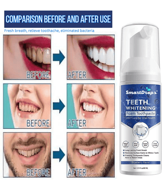 Smartdrops Standard Oral Kit