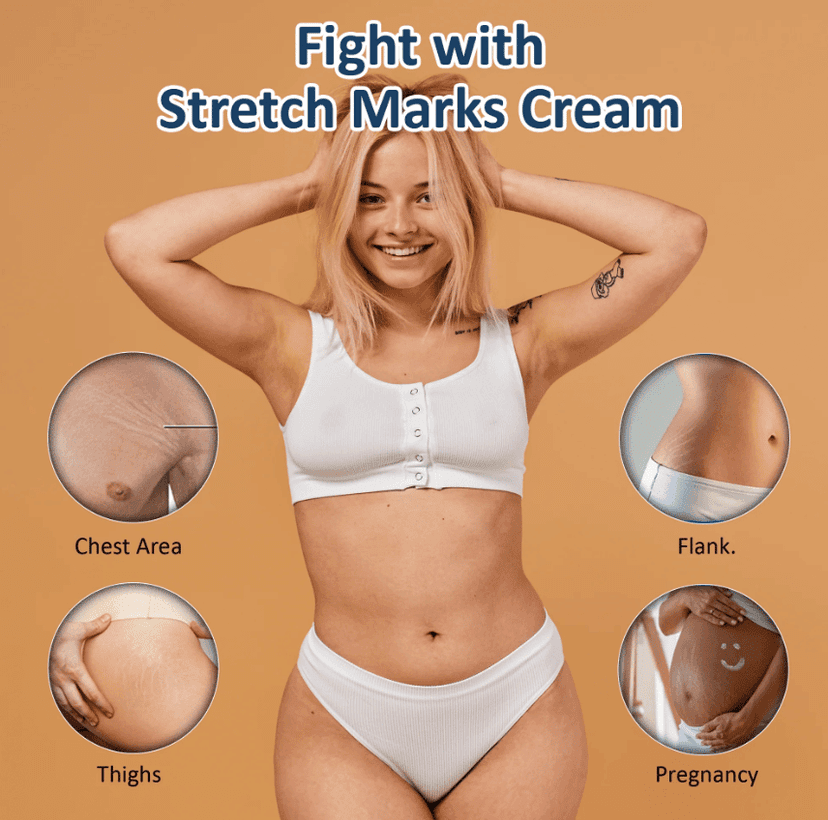 Stretch Mark Removal Cream for Pregnancy - 100g Pack of 1 | Natural Formula with Almond Oil & Kokum Butter for Skin Elasticity & Stretch Marks Prevention view 5