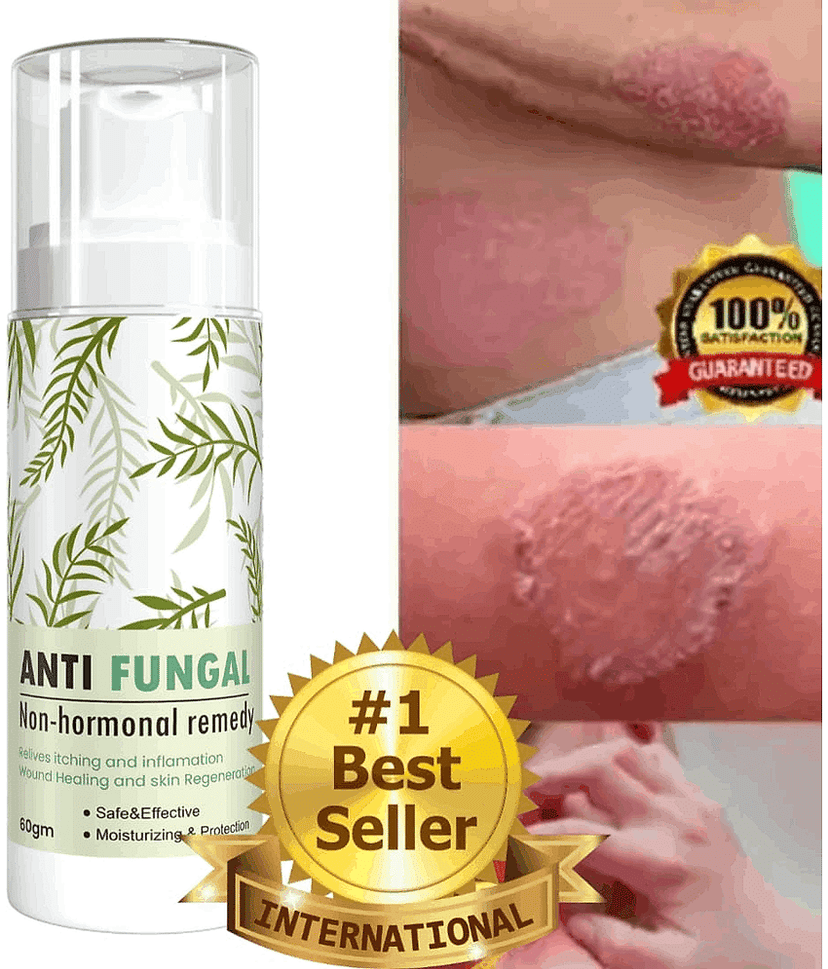 GRASHVA ORGANIC Anti-Itch Cream For Eczema Skin 50 ml ( Pack of 1 )