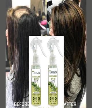 Treszo Rosemary Hair Growth Hair Serum 100 mL Pack of 2