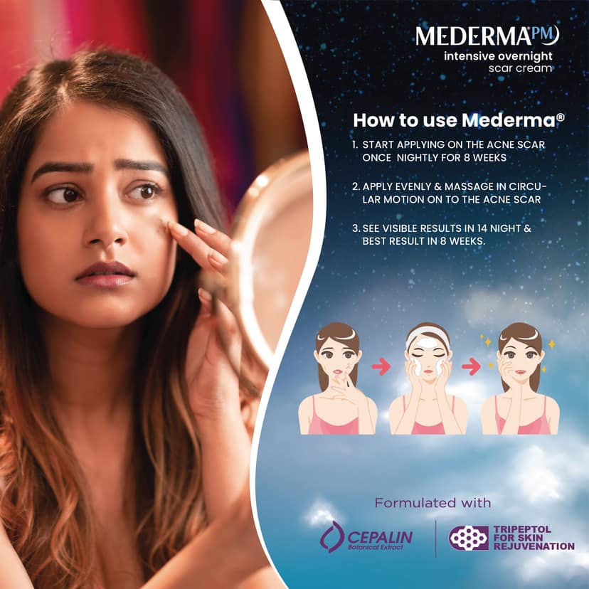 Mederma PM Old & New Acne Scar Removal Cream 30g view 5