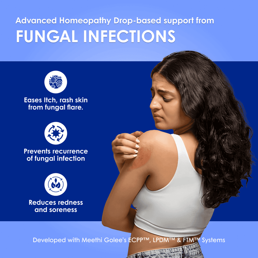 Meethi Golee Fungal Clear Drops for Skin Comfort Support (30ml) | Advanced Homeopathy 2.0 Skin & Immune Balance Formula for Itching, Redness & Recurrent Fungal Sensitivity | Fast Absorbing Oral Drops view 2