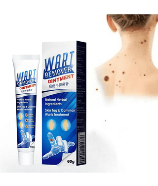 Massa Remover Cream for Warts Safely Painless Cream Skin Treatment