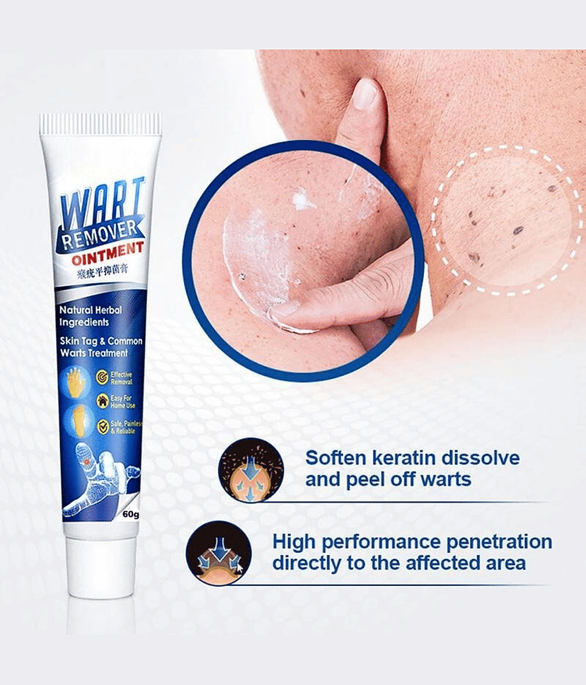 Massa Remover Cream for Warts Safely Painless Cream Skin Treatment view 2