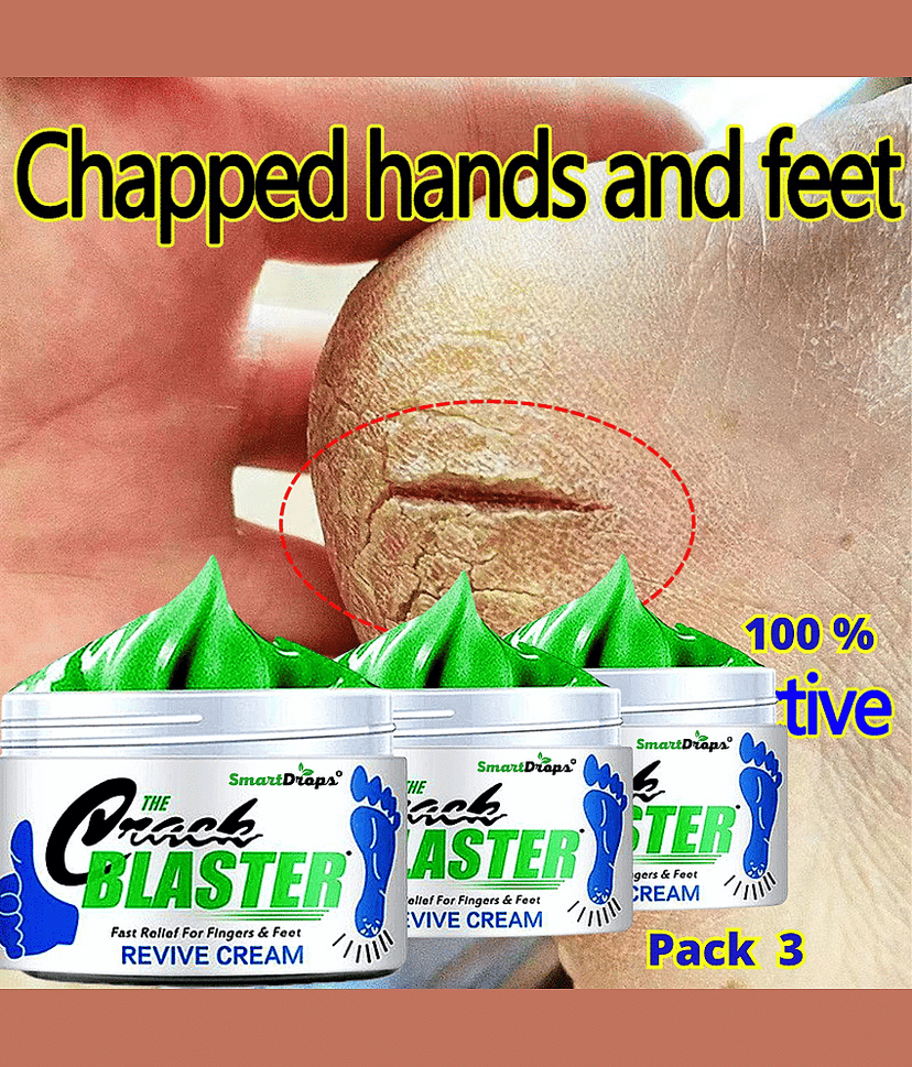 Smartdrops Nourishing Dry Cracked Foot Cream Foot Cream ( 150 g ) Pack of 3