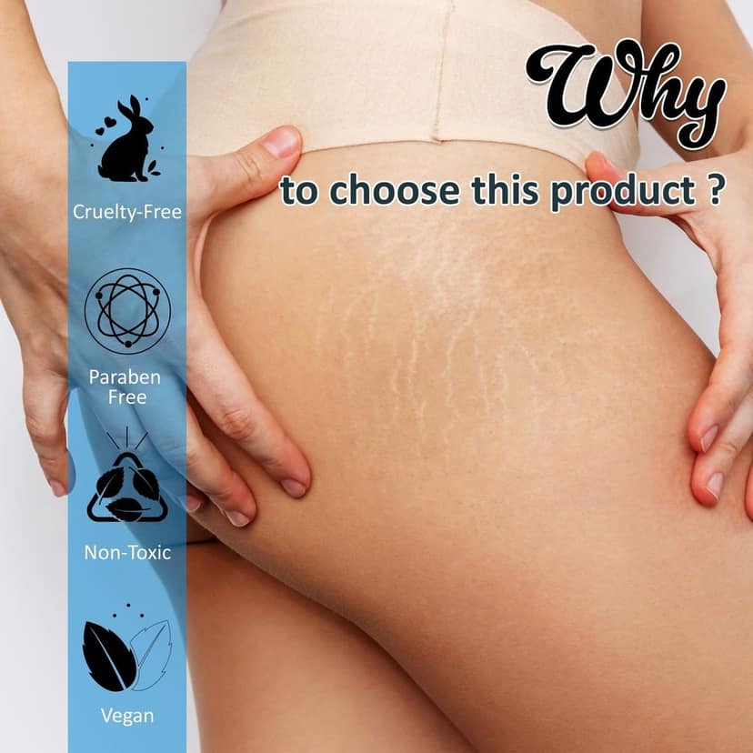 Stretch Mark Removal Cream During Pregnancy | 7Days Natural view 7