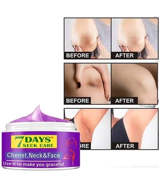 Treszo Black & White Head Removal Cream ( 50 g )