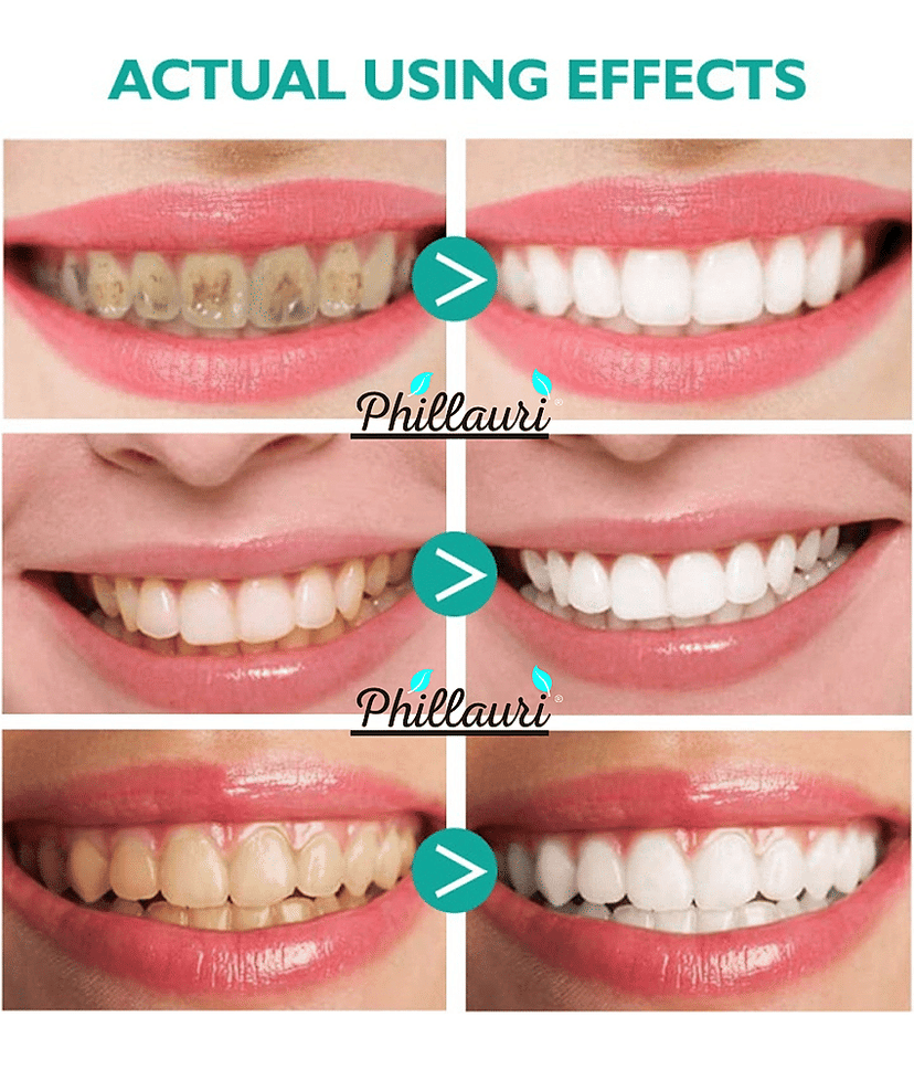 Phillauri Natural Standard Oral Kit view 2