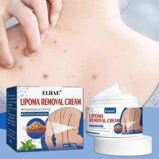 ELHAE Herbal Lipoma Cream Peeling Fat Mass Remove Miracle Ointment Safe Chinese Medicines Beauty Health Promotion
