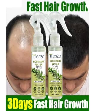 Treszo Rosemary Hair Growth Hair Serum 100 mL Pack of 2