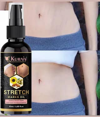 Kuraiy Natural Stretch Oil with Coconut, Olive & Jojoba Oils, For Scars & Stretchmark Oil