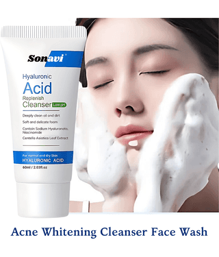Smartdrops - Blackheads and Whiteheads Removal Face Wash For All Skin Type ( Pack of 1 )