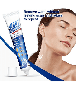 Wart Remover Cream For Blackhead remover, Pimple remover, Dead skin remover Cream