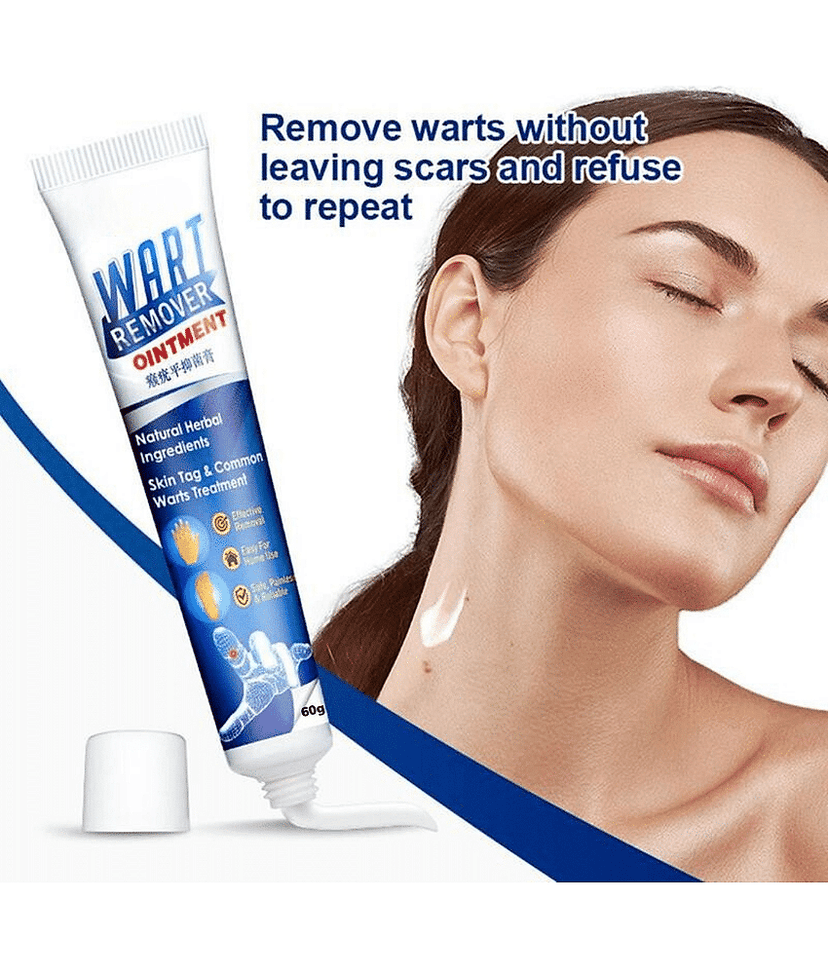 Wart Remover Cream For Blackhead remover, Pimple remover, Dead skin remover Cream