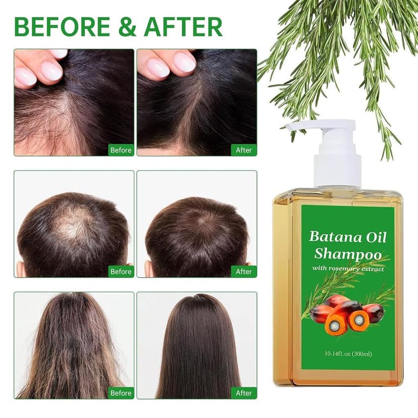 ELHAE Batana Oils Shampoo With Rosemary Extract | For All Hair Types | Nourishing Cleanser That Helps Moisturize & Strengthen Scalp and Hair | Gentle Use Daily Shampoo (300ml) view 5