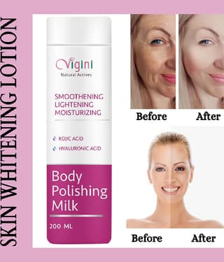 Vigini 100% Natural Active Skin Lightening Whitening Body Polishing Milk Lotion With Kojic & Hyaluronic Acid, UnderArms Under Arms Brightening Cream, Removes / Removal D-Tan Pigmentation Dark Spots For Men & Women-200ml
