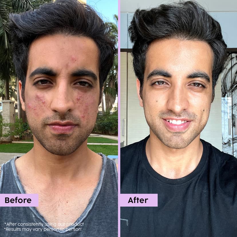 Jamun Oil-Balancing Sunscreen (with SPF 50 for Everyday Sun Protection) __Starter Pack__ view 4