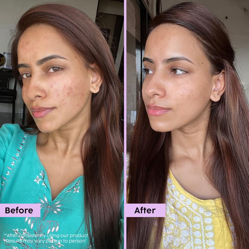 Jamun Oil-Balancing Sunscreen (with SPF 50 for Everyday Sun Protection) __Starter Pack__ view 5
