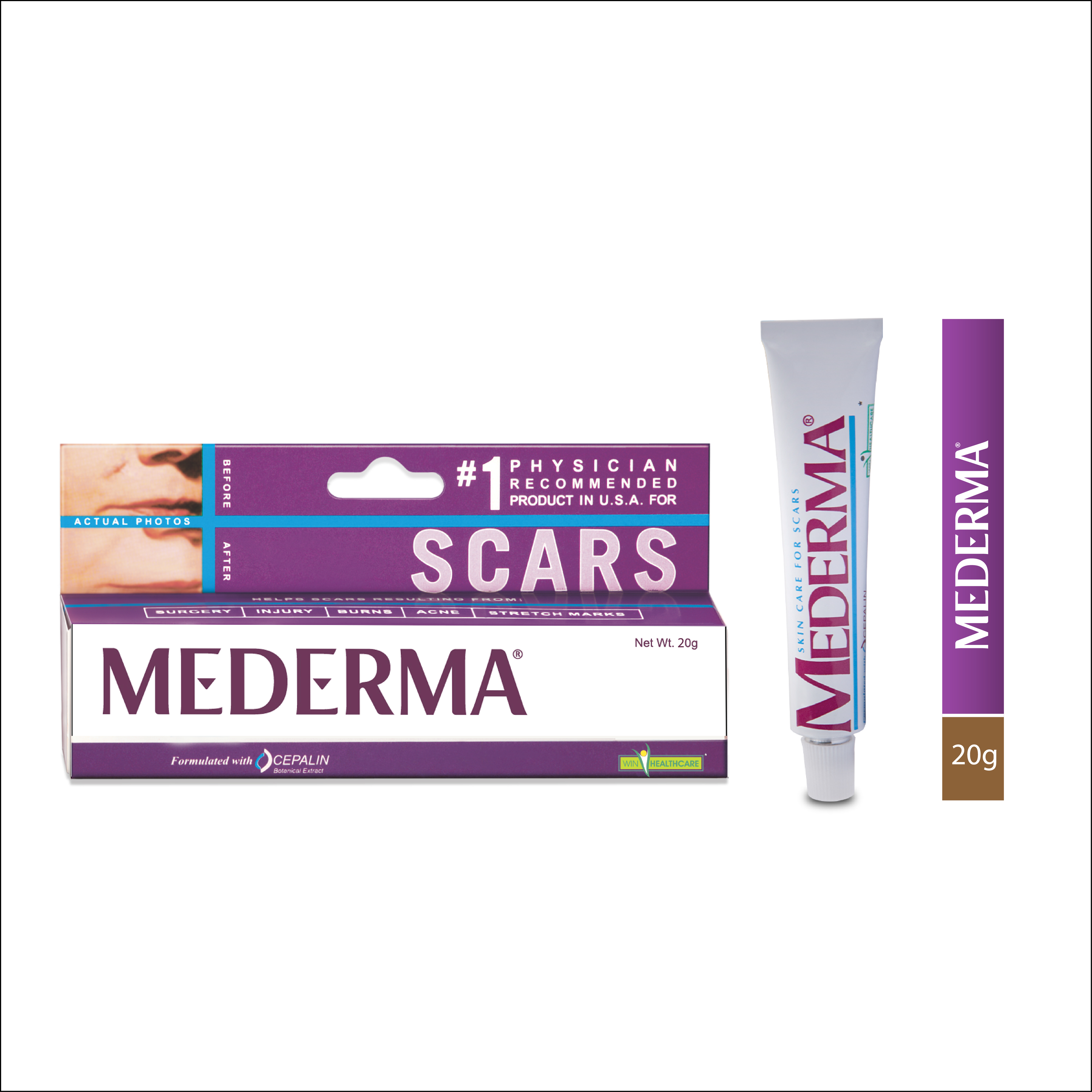 MEDERMA Skin Care Cream for Scars (20 g)