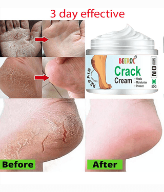 BEEROC Cracked skin repair Cream for ( 50 g )