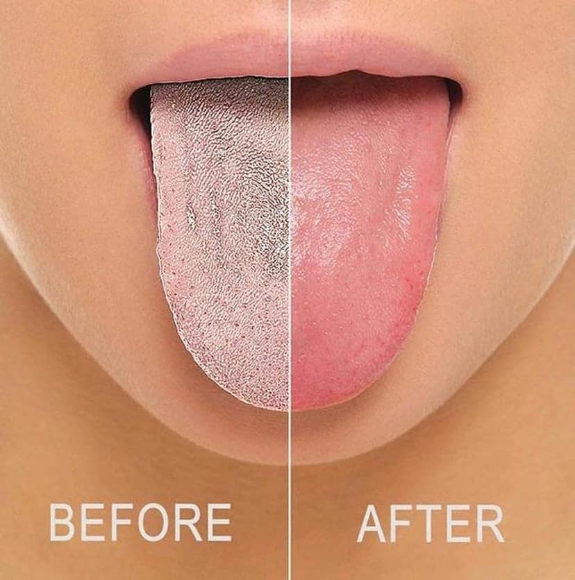 Elecsera Soft Double Action Tongue Cleaner Scrapper For Kids and Adults With Travel Capsule Plastic Tooth brush paste holder flexible design for health, Oral care tool Easy To use 5pcs view 2